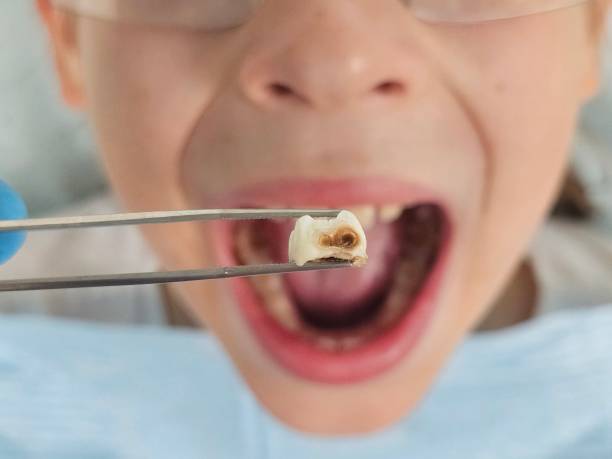 Best Emergency Dental Care for Sports Injuries in China Lake Acres, CA